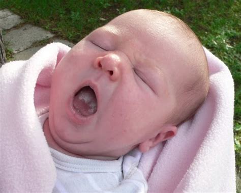 Thrush Of The Mouth In Babies Pictures