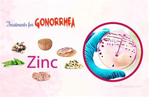 17 Natural Treatments For Gonorrhea In Males And Females