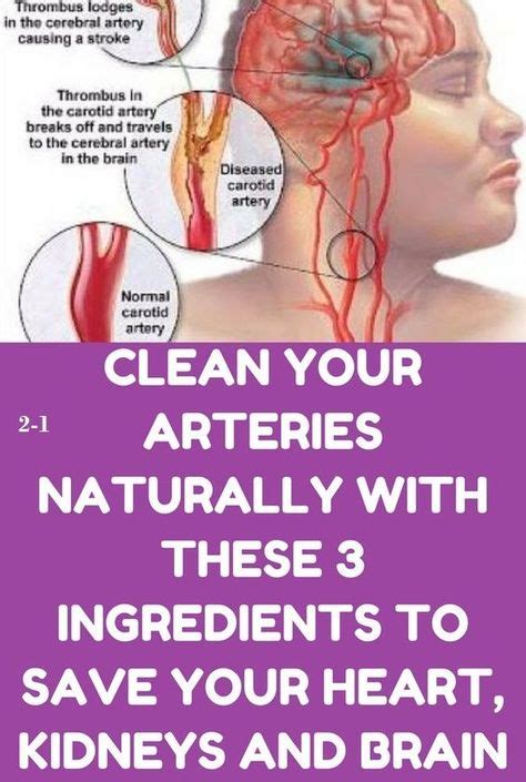 how to clean out plaque in arteries 3 ingredients mixture health and fitness tips health