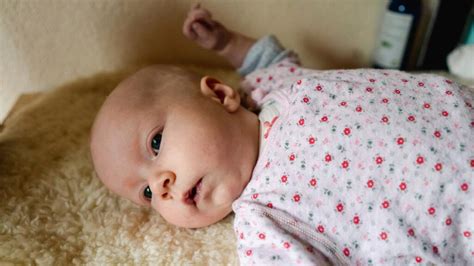 Baby Seizure Symptoms Causes Diagnosis Treatment