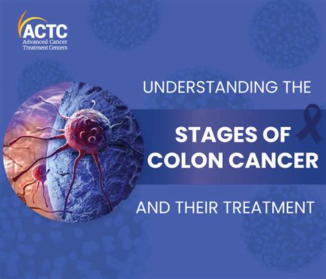 Understanding The 5 Stages Of Colon Cancer