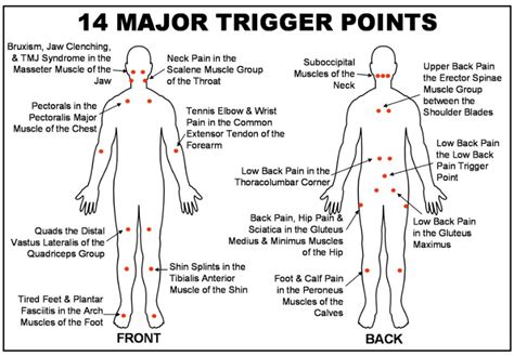 what is trigger point therapy