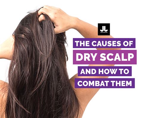The Causes Of Dry Scalp And How To Combat Them Joujou Hair Studio