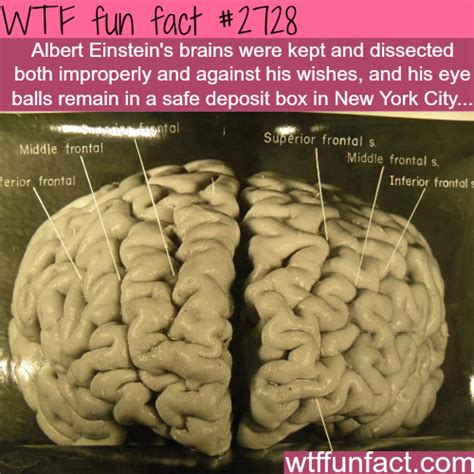 Albert Einsteins Brains Wtf Fun Facts Wtf Fun Facts Fun Facts