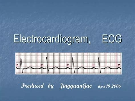 Ppt Electrocardiogram Ecg Powerpoint Presentation Free Download