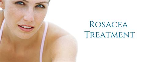 Rosacea Treatment Pictures Causes Diet And Triggers Women Daily Magazine