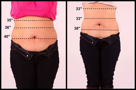 Before And After 6 Treatments Using Wow Cavitation Total Loss Of 7 Body Contouring Beauty
