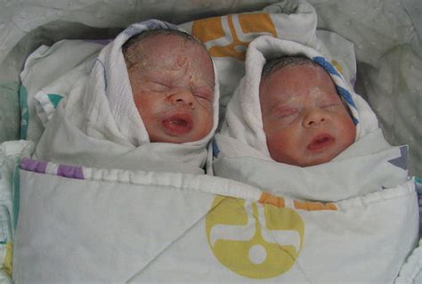 Are Twins Double The Medical Expense To Deliver