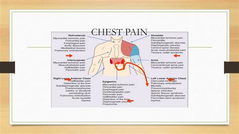 Ppt Chest Pain Powerpoint Presentation Free Download Id6039641