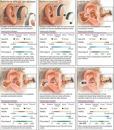Widex Hearing Aid Parts Diagram