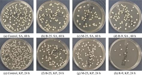 Growth Of Bacterial Colony On Tsa Plates Inoculated With Different