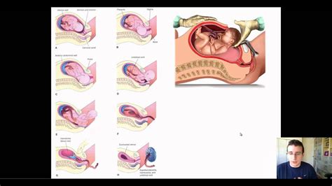 Factos Of Successful Pregancies And Human Reproduction Review Youtube