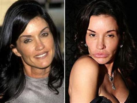 Janice Dickinson The World S Most Expensive Celebrity Plastic Surgeries Plastic Surgery