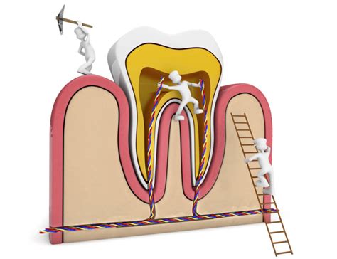 March 9th, 2021 3pm if you have a deep cavity that can't be solved by a filling, or even a cracked or infected tooth, then your dentist will likely suggest either a root canal or a complete extraction to solve the problem. Do I Really Need a Root Canal? Let the Experts Answer!