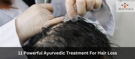 Powerful Ayurvedic Treatment For Hair Loss