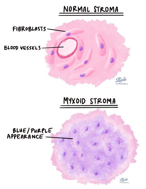 Myxoid Pathology Dictionary Mypathologyreportca