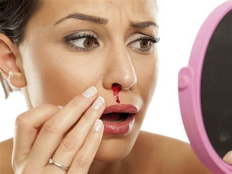 10 Home Remedies To Stop Nose Bleeding Instantly