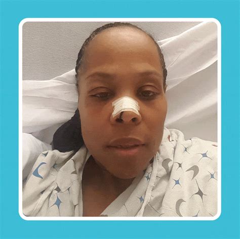 “my Sinus Infection And Runny Nose Turned Out To Be A Brain Fluid Leak” Sinus Infection