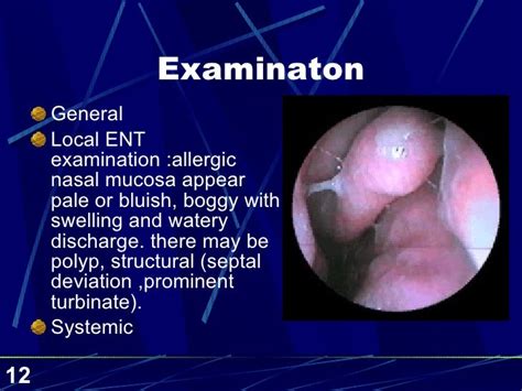 Ent 5th Year 3rd Lecture Dr Yousif Chalabi