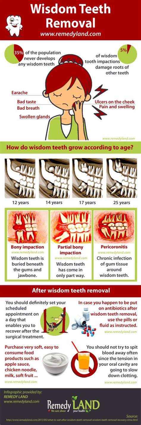 Wisdom Teeth Removal Infographic Infografías Pinterest Teeth