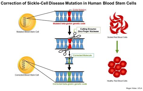Ucla Stem Cell Researchers Develop Promising Method To Treat Sickle