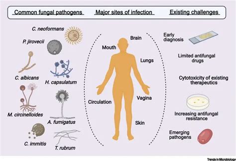 Mycosis Etiology Types And Classification Microbe Online