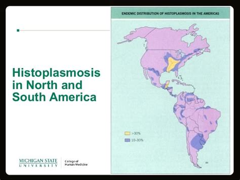 Overview Of Histoplasmosis
