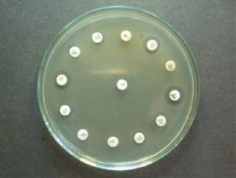 Kirby Bauer E Coli Disc Diffusimetric Antibiogram Multiple Resistance