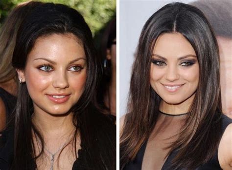 Mila Kunis Before And After Plastic Surgery Celebrity Plastic Surgery Online