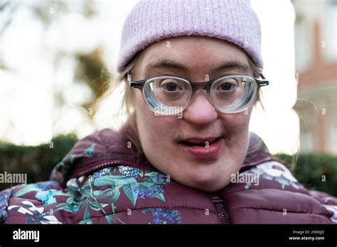 Close Up Portrait Of A 39 Year Old White Woman With Down Syndrome Stock