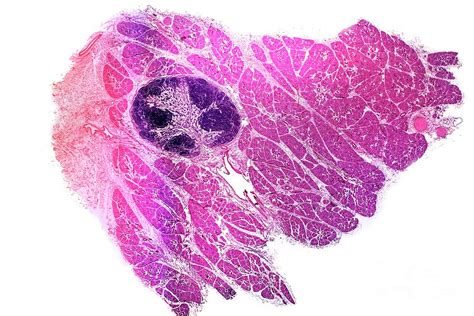 Parotid Salivary Gland Photograph By Dr Keith Wheelerscience Photo