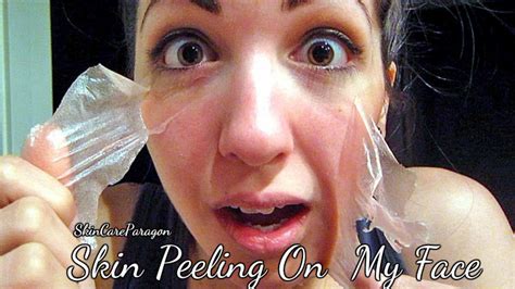 There is no wrong order in doing this, it is just how. Skin Peeling On Face - Signs, Symptoms, And Treatment