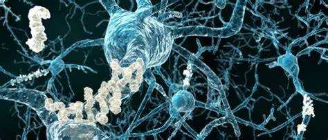 Uncommon change quality in Alzheimer's could assist with early analysis
