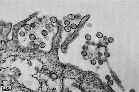 Hantavirus infections definition hantavirus infection is caused by a group of viruses that can infect humans with two serious illnesses: Death of Washington mother of 3 linked to hantavirus | The ...