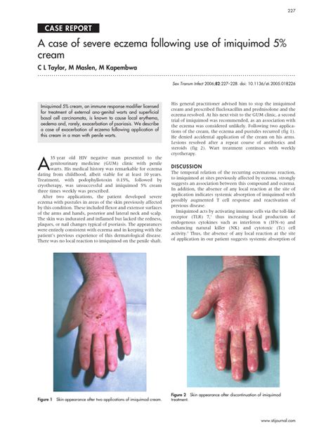 Pdf A Case Of Severe Eczema Following Use Of Imiquimod 5 Cream