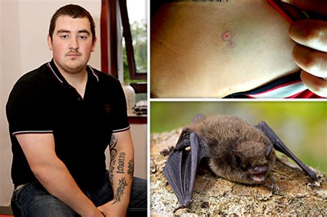 Terrified Scots Dad Reveals He Feared Catching Deadly Rabies After