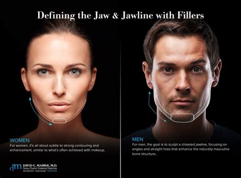 Jawline Filler For Definition And Contour Updated 2023 Mabrie Facial