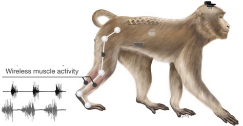 Researchers Restore Leg Movement In Primates Using Wireless Neural