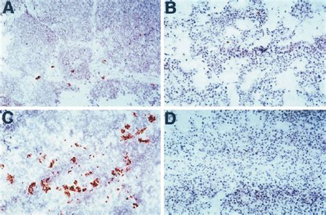 Immunohistochemical Analysis Of Tumor Infiltrating Dendritic Cells Dc Download Scientific