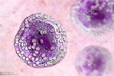 Burkitts Lymphoma Cell Is A Cancer Of The Lymphatic System Stock Photo
