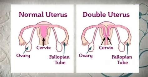 These Women Were Born With Two Vaginas Yep Two