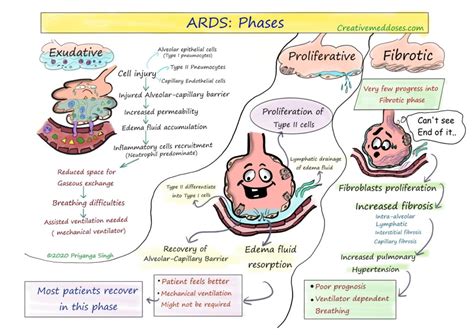 Acute Respiratory Distress Syndrome ARDS Creative Med Doses