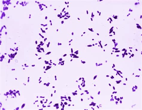 Streptococcus Pneumoniae Agentes Biológicos Bacteria