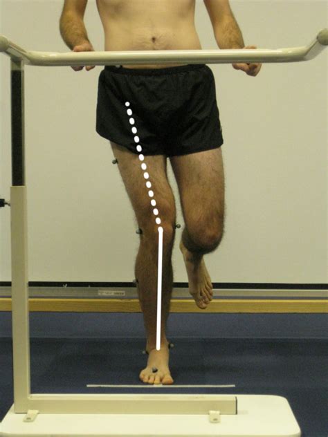 Knee Medial To Foot Position During The Single Limb Mini Squat