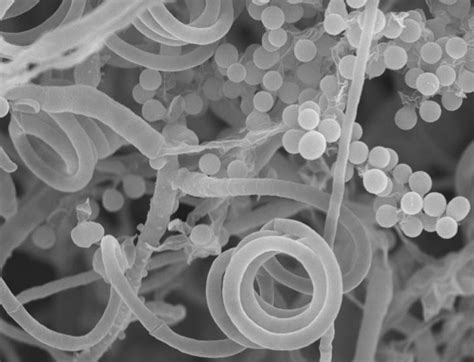 Toenail Fungus Gives Up Sex To Infect Human Hosts Eurekalert Science