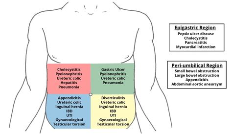 The Ileus Types Of Peritonitis The Acute Abdomen Greek Doctor