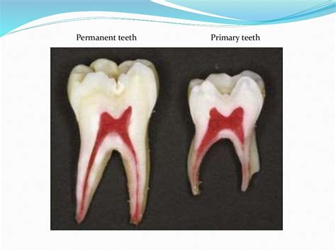 Difference Between Primary And Permanent Dentition