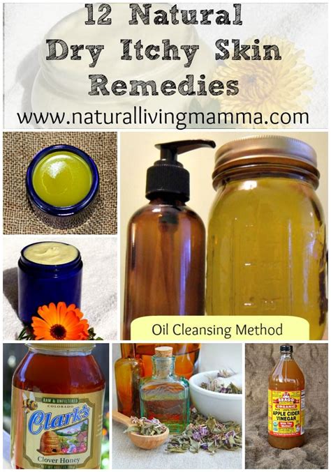 12 Natural Dry Itchy Skin Remedies Natural Living Mamma Dry Itchy Skin Remedies Itchy Skin