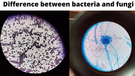 Differences And Similarities Between Bacteria And Fungi Microbe Online