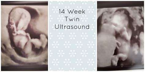 Pregnancy Update 14 Weeks Pregnant With Twins